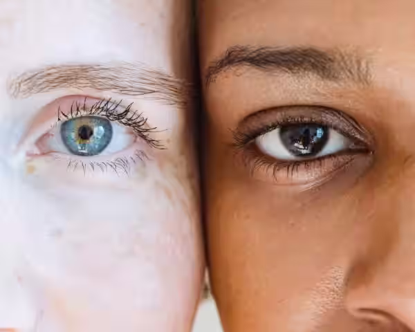 Presbyopia